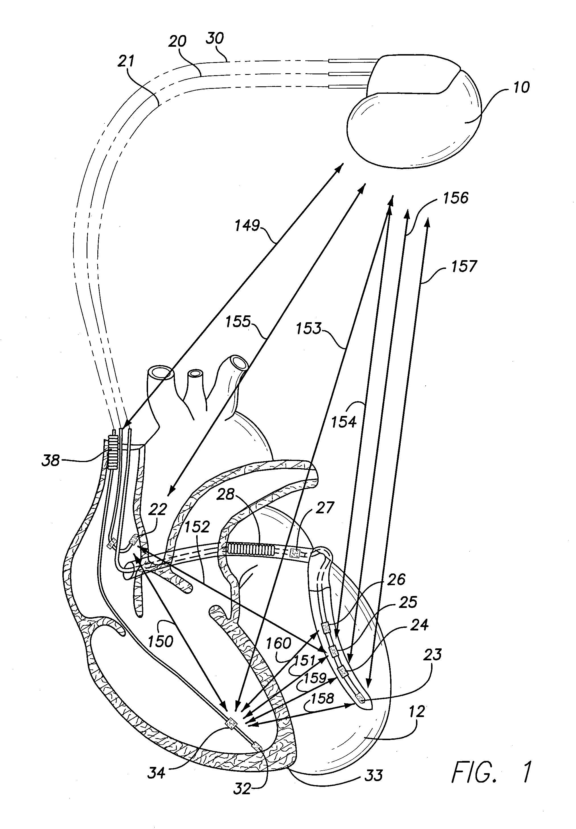 Methods and systems for analyzing valve related timing and monitoring heart failure