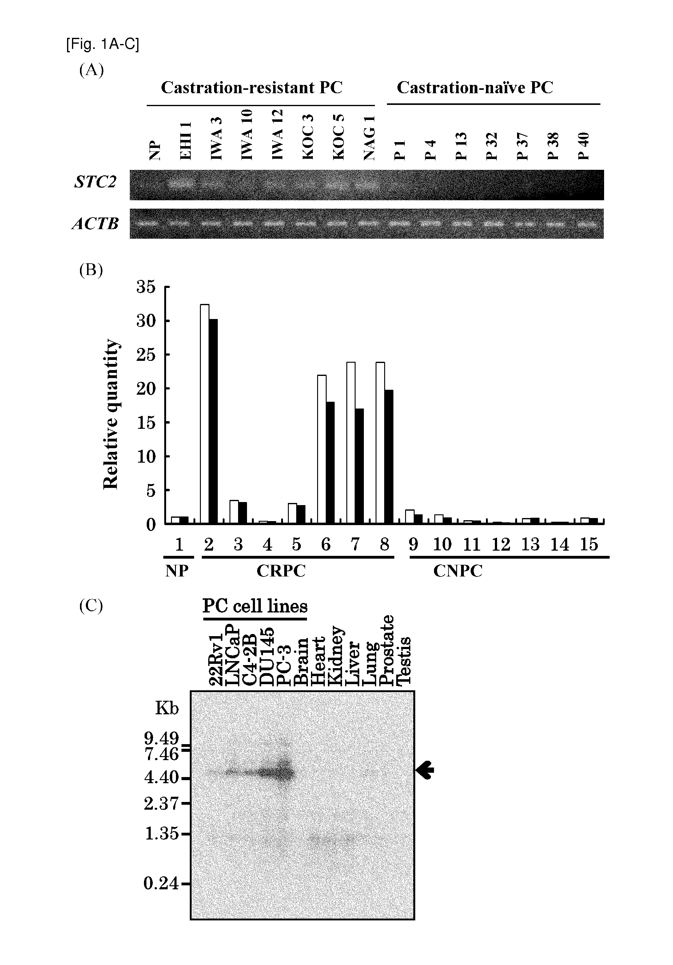 Methods for diagnosing or treating prostate cancer