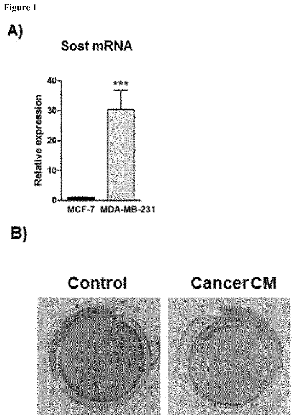 Use of a sclerostin antagonist