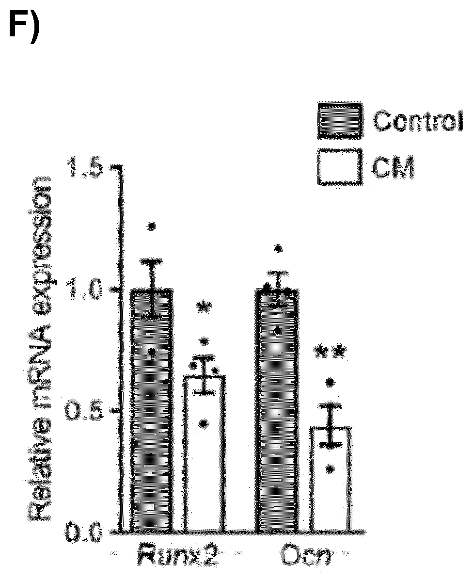 Use of a sclerostin antagonist