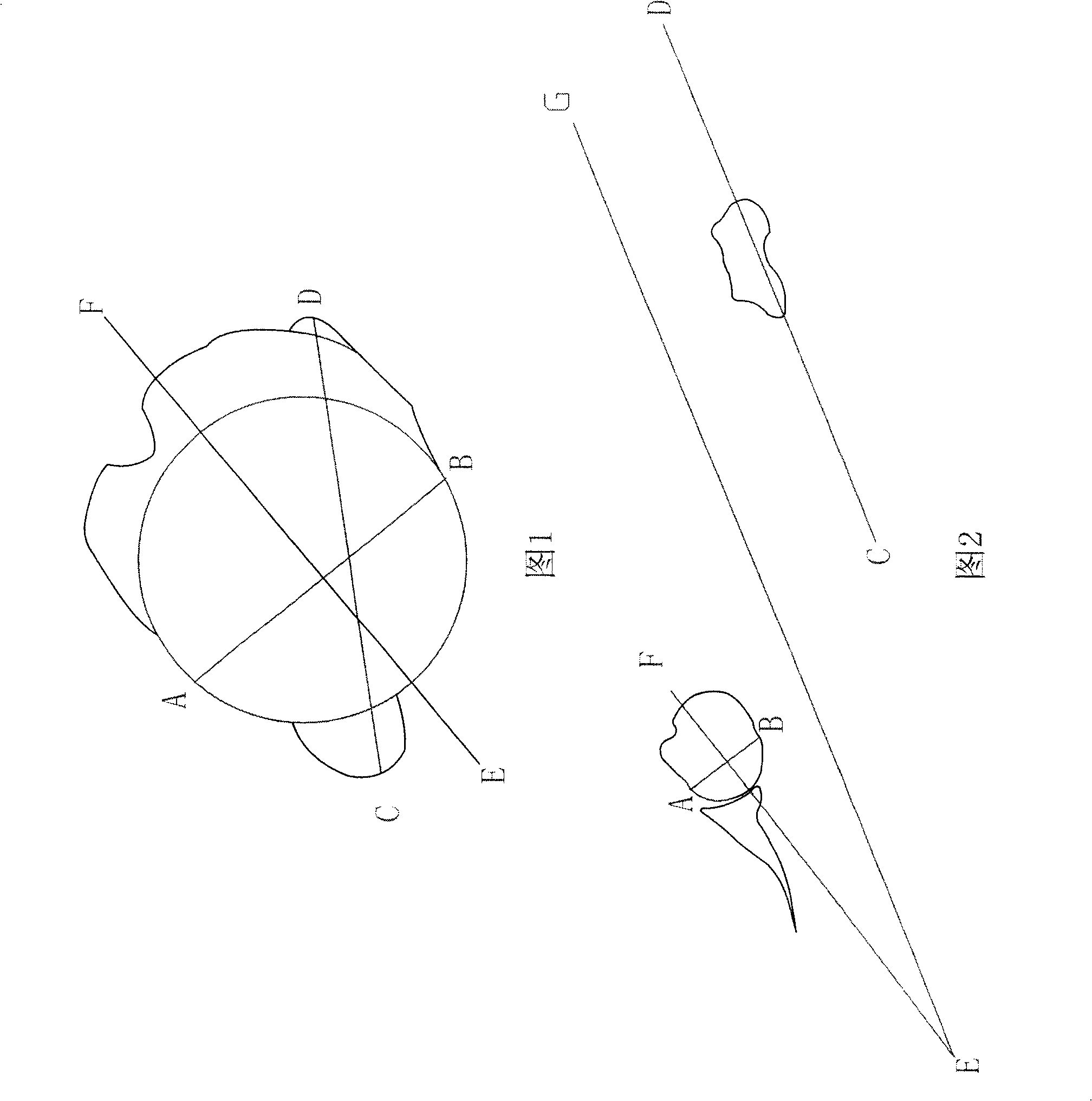 Method for measuring turning angle of humerus by using multiple line of CT three-D remodelling