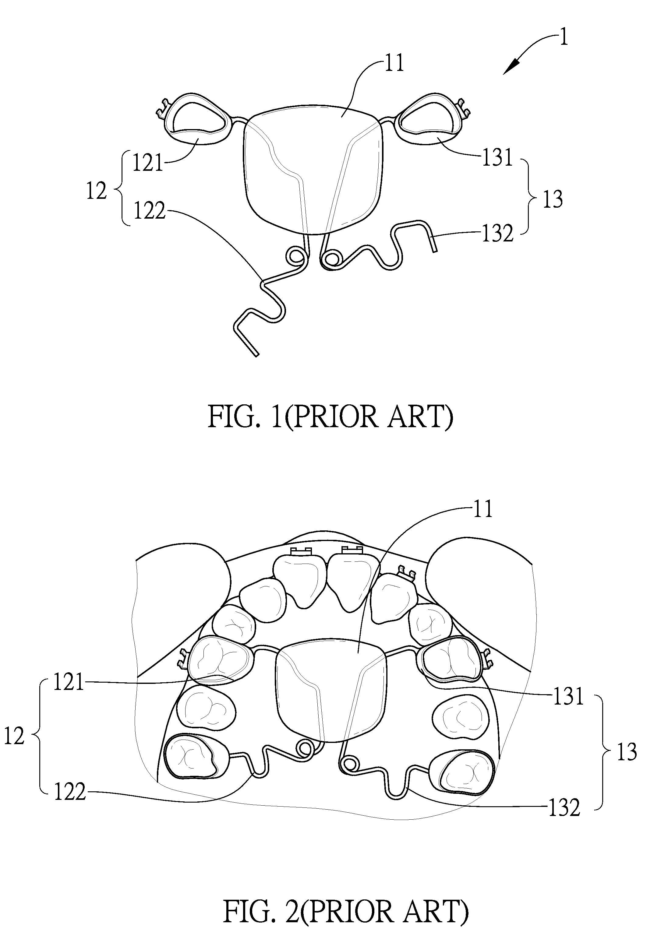 Orthodontic Maxillary Micro Implant