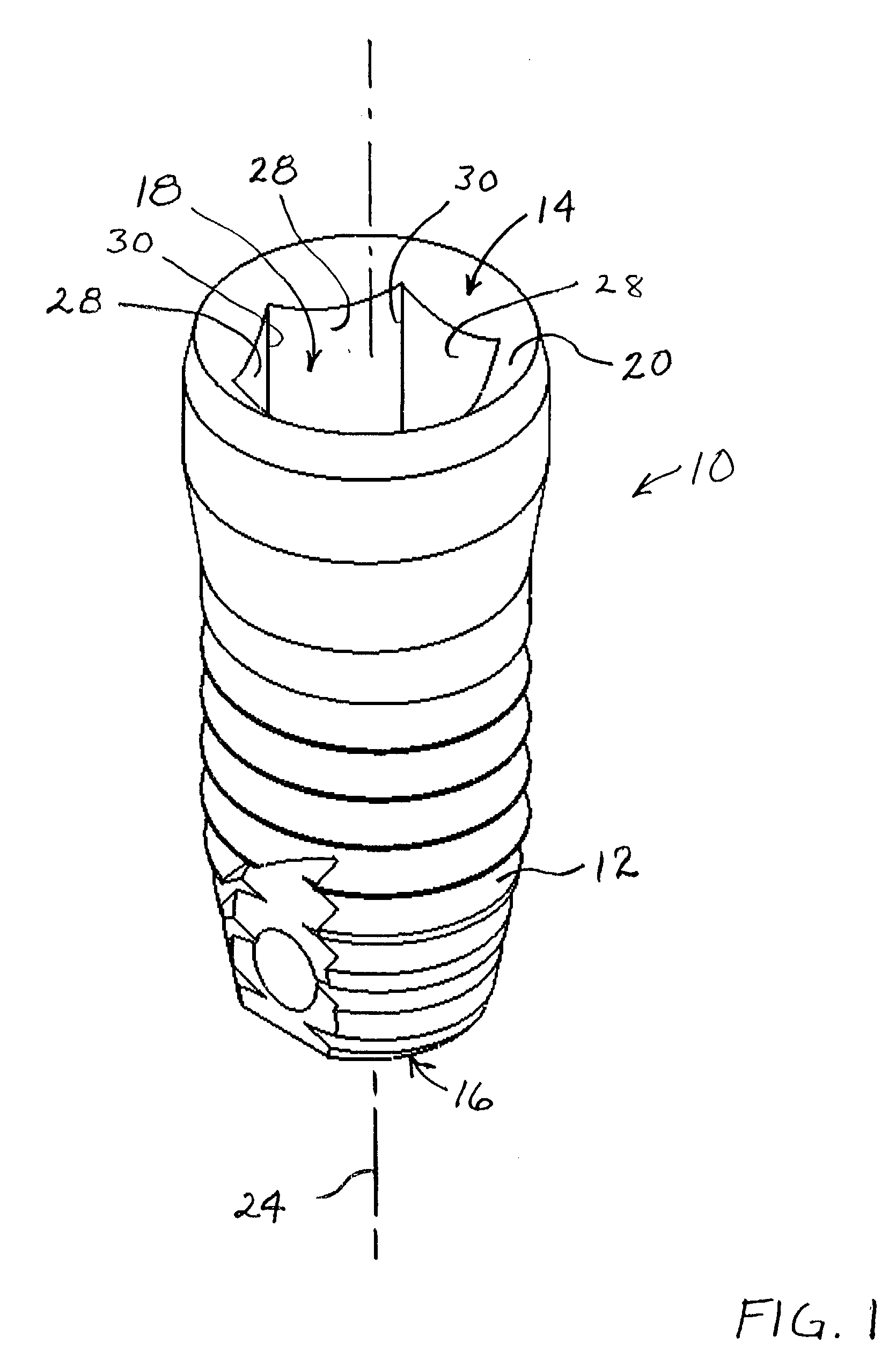 Rotationally immobilized dental implant and abutment system