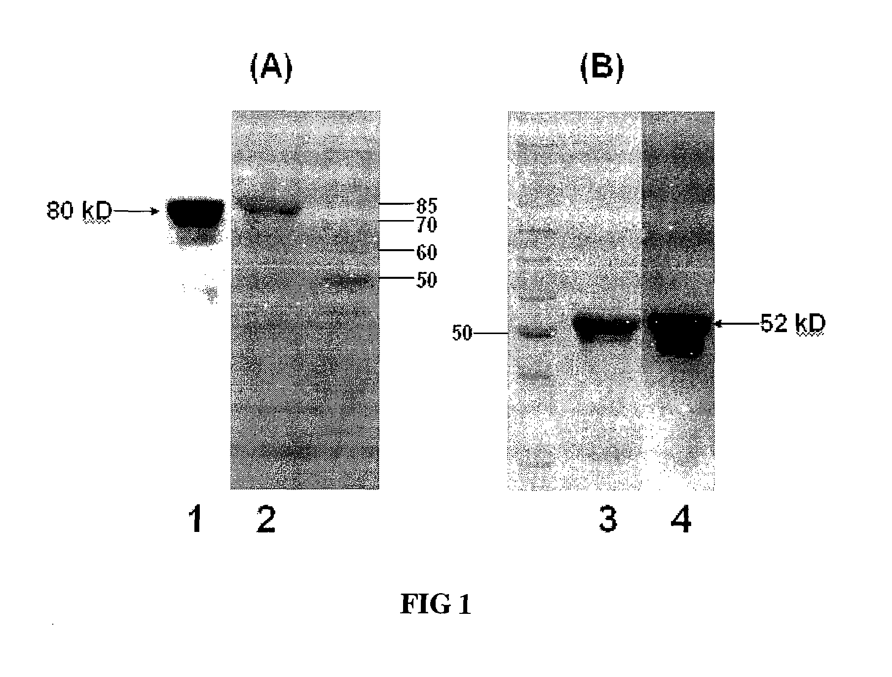 Carious tooth vaccine and preparation method