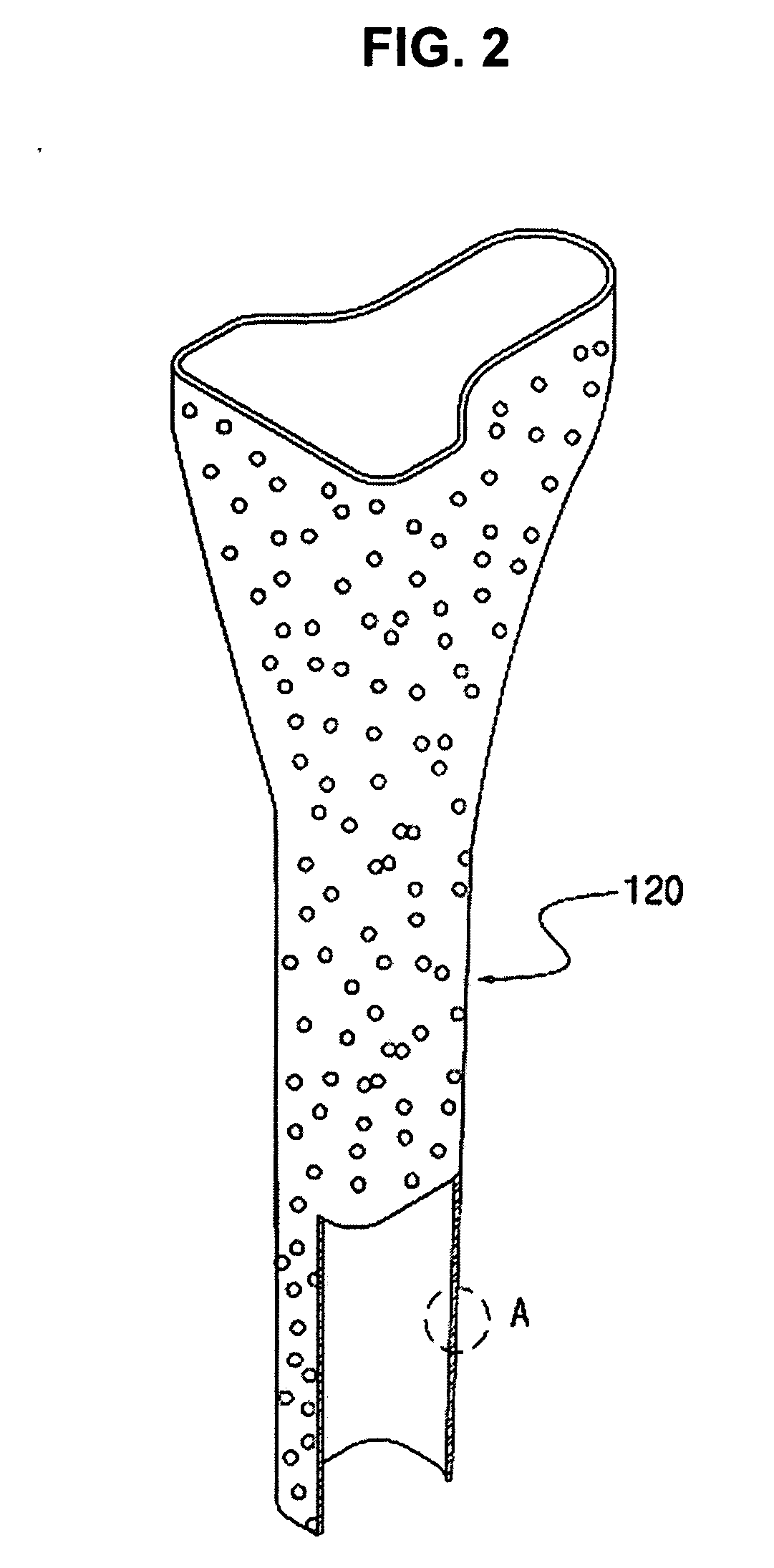 Artificial joint system