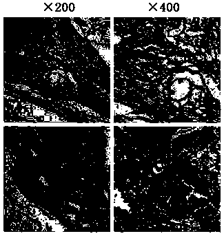 Design of cancellous bone bionic scaffold prepared by 3d printing technology and application thereof