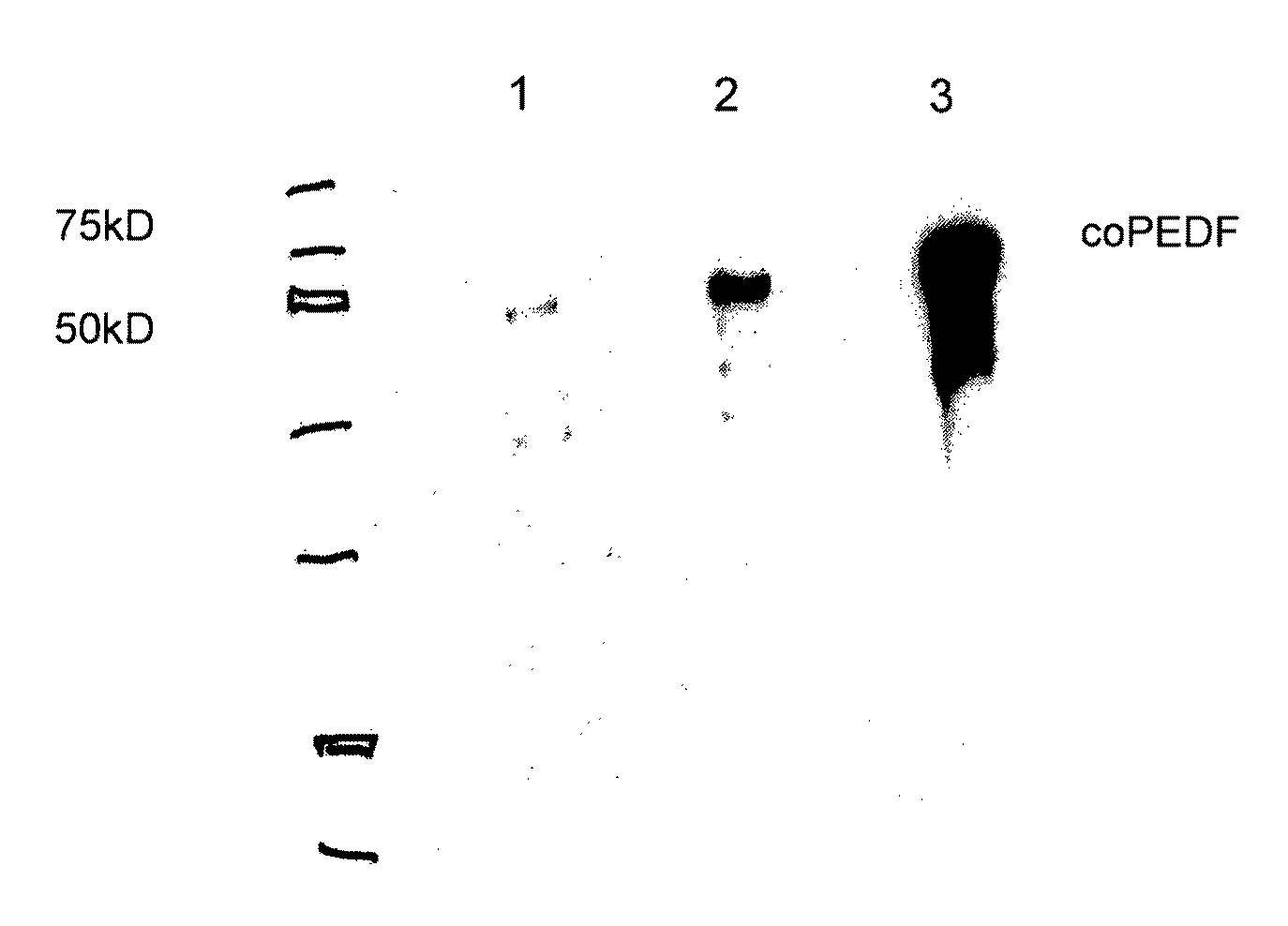 Compositions and Methods for Use of Pigment Epithelial Derived Factor (PEDF) Peptide Fragments