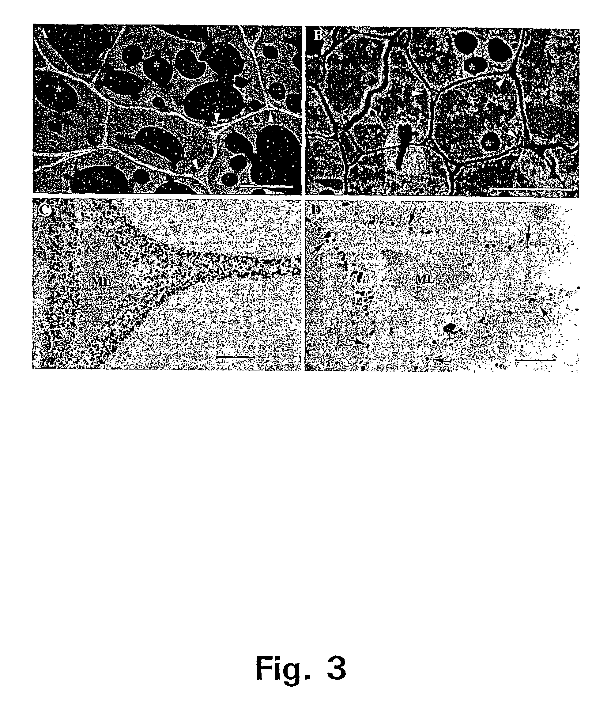 Method for remodelling cell wall polysaccharide structures in plants