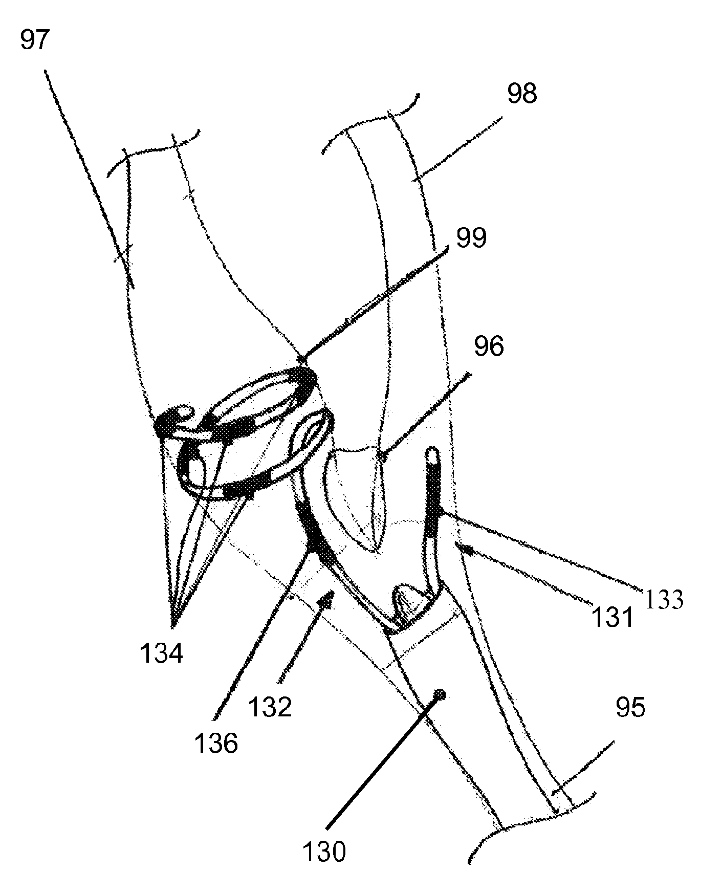 Endovascular electrostimulation near a carotid bifurcation in treating cerebrovascular conditions