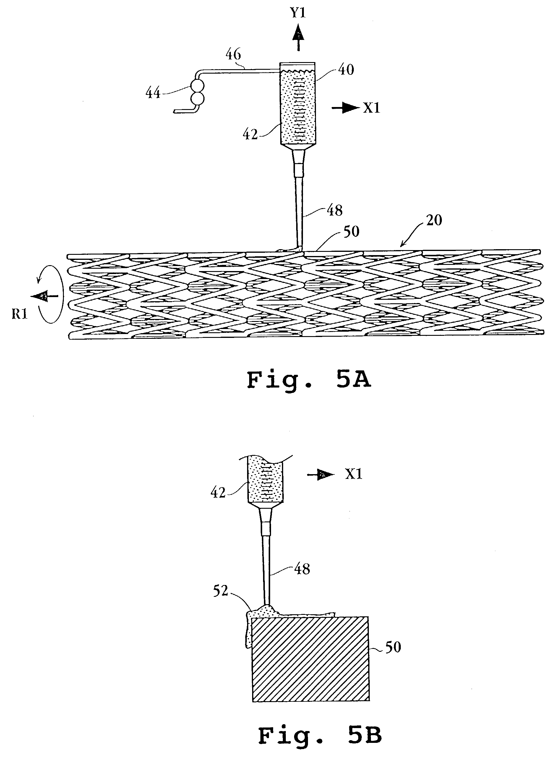 Drug-delivery endovascular stent and method for treating restenosis