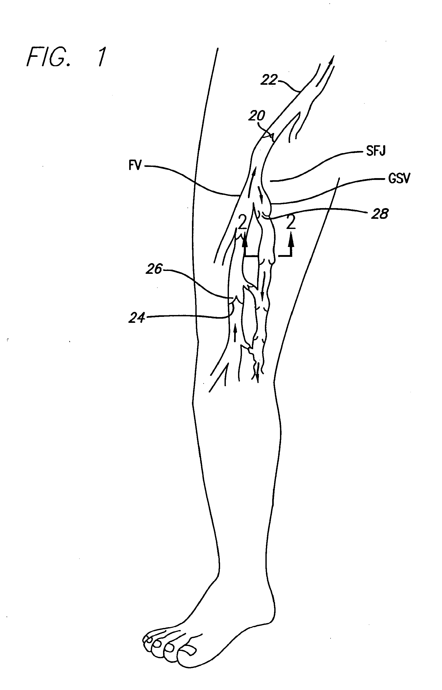 Method and apparatus for positioning a catheter relative to an anatomical junction
