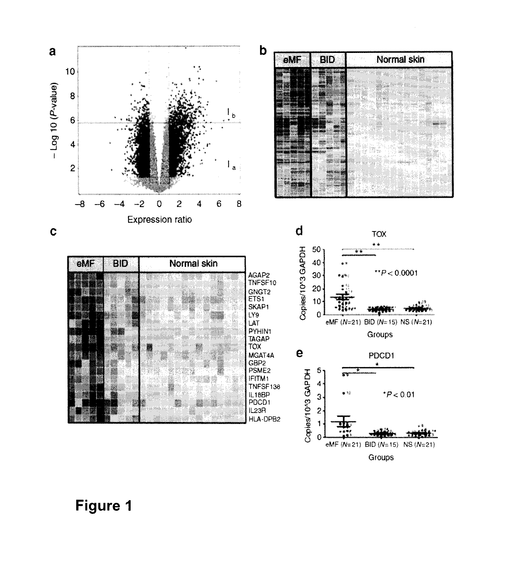 Biomarkers for t cell malignancies and uses thereof