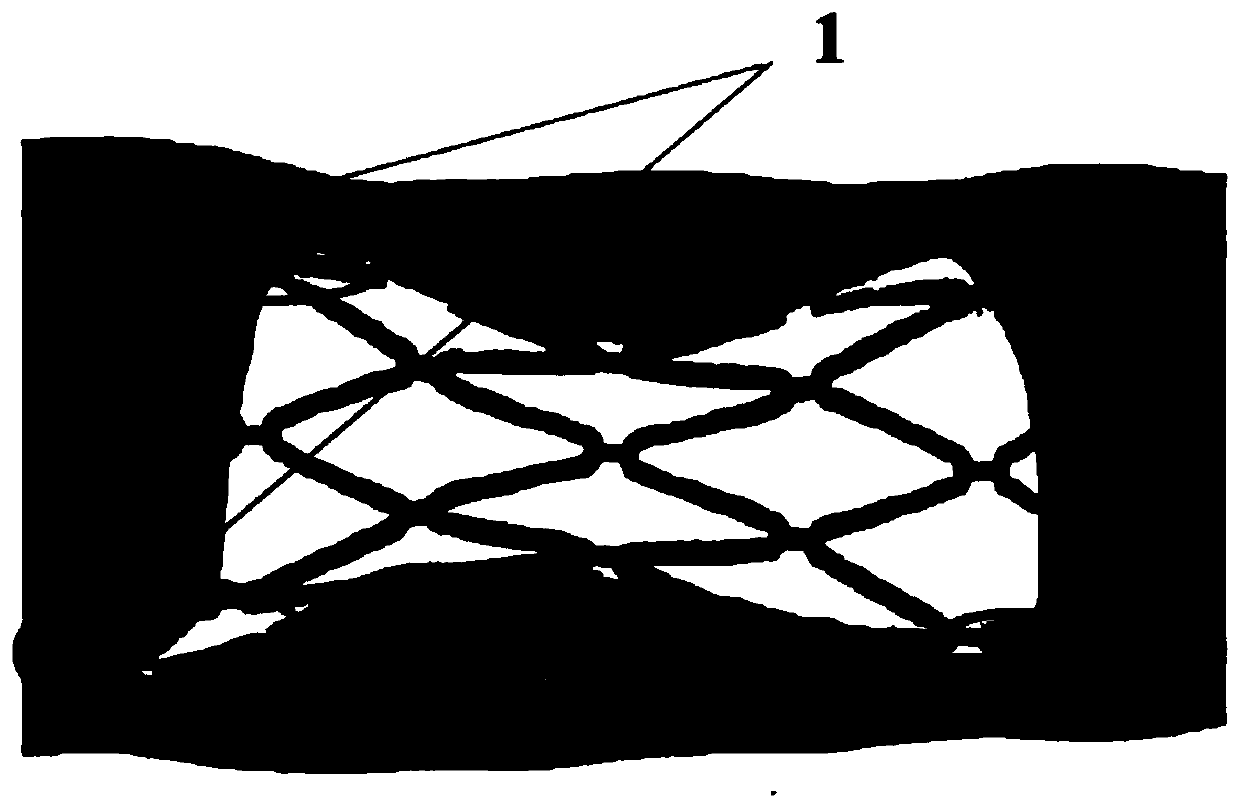 Conformal wall-attached endovascular stent