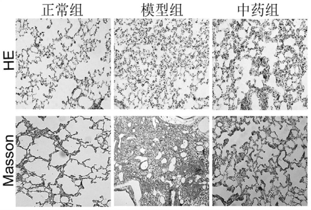 A kind of traditional Chinese medicine composition and its application in preparing medicine for treating pulmonary fibrosis disease