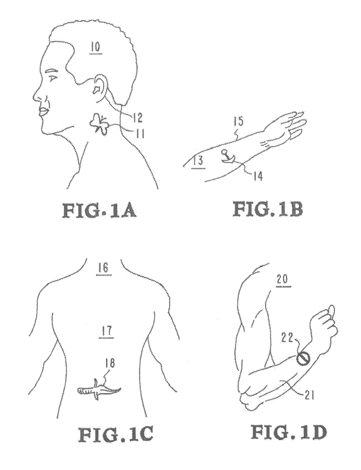 Detection and tracking system using tattoos