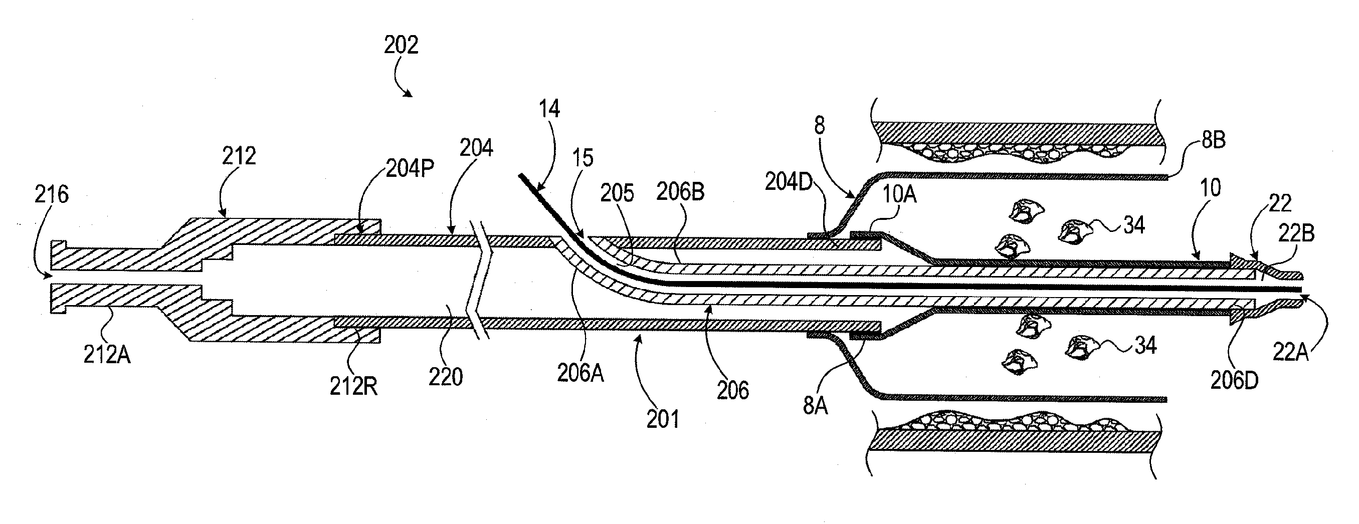 Balloon catheter and methods of use thereof