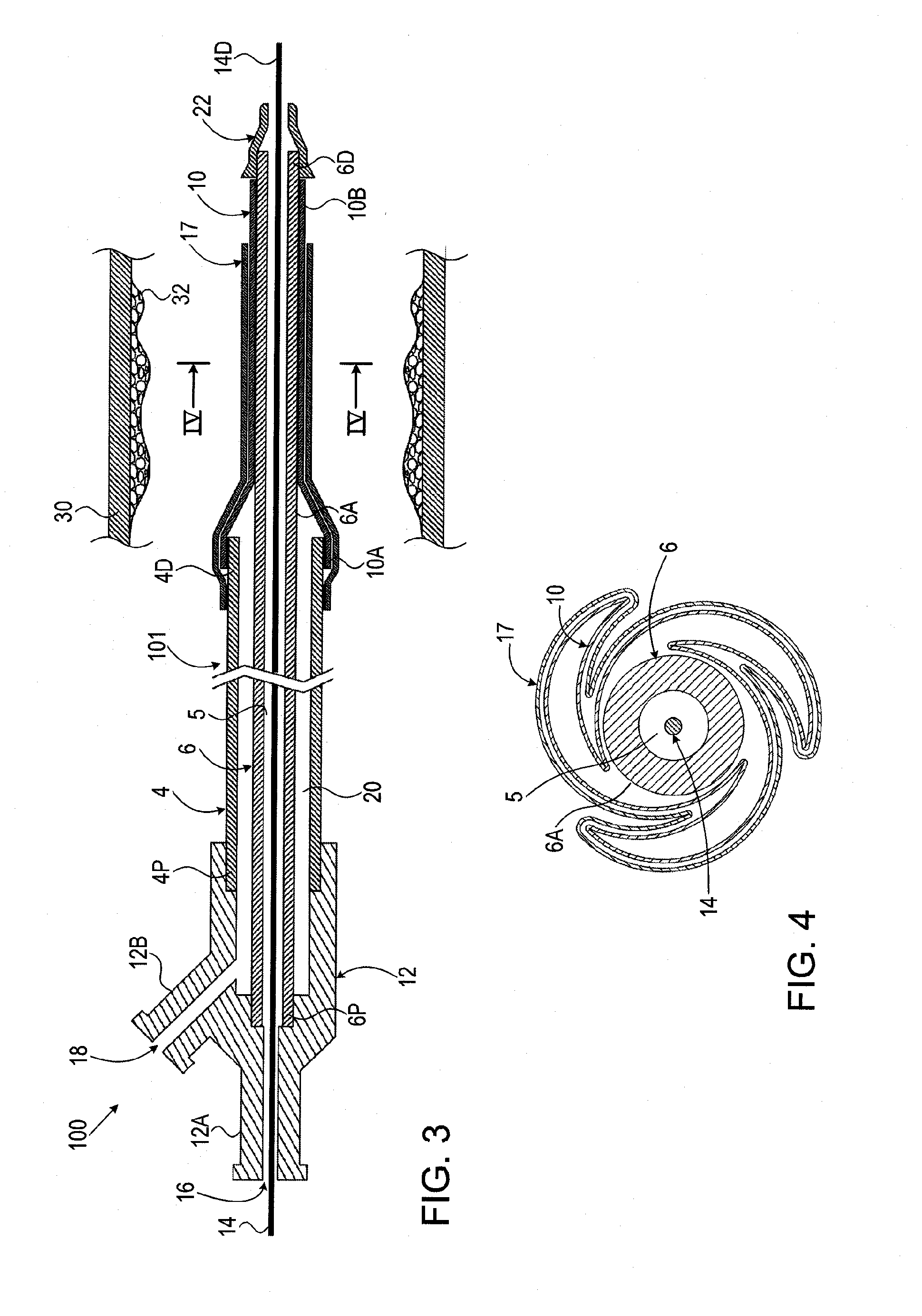 Balloon catheter and methods of use thereof