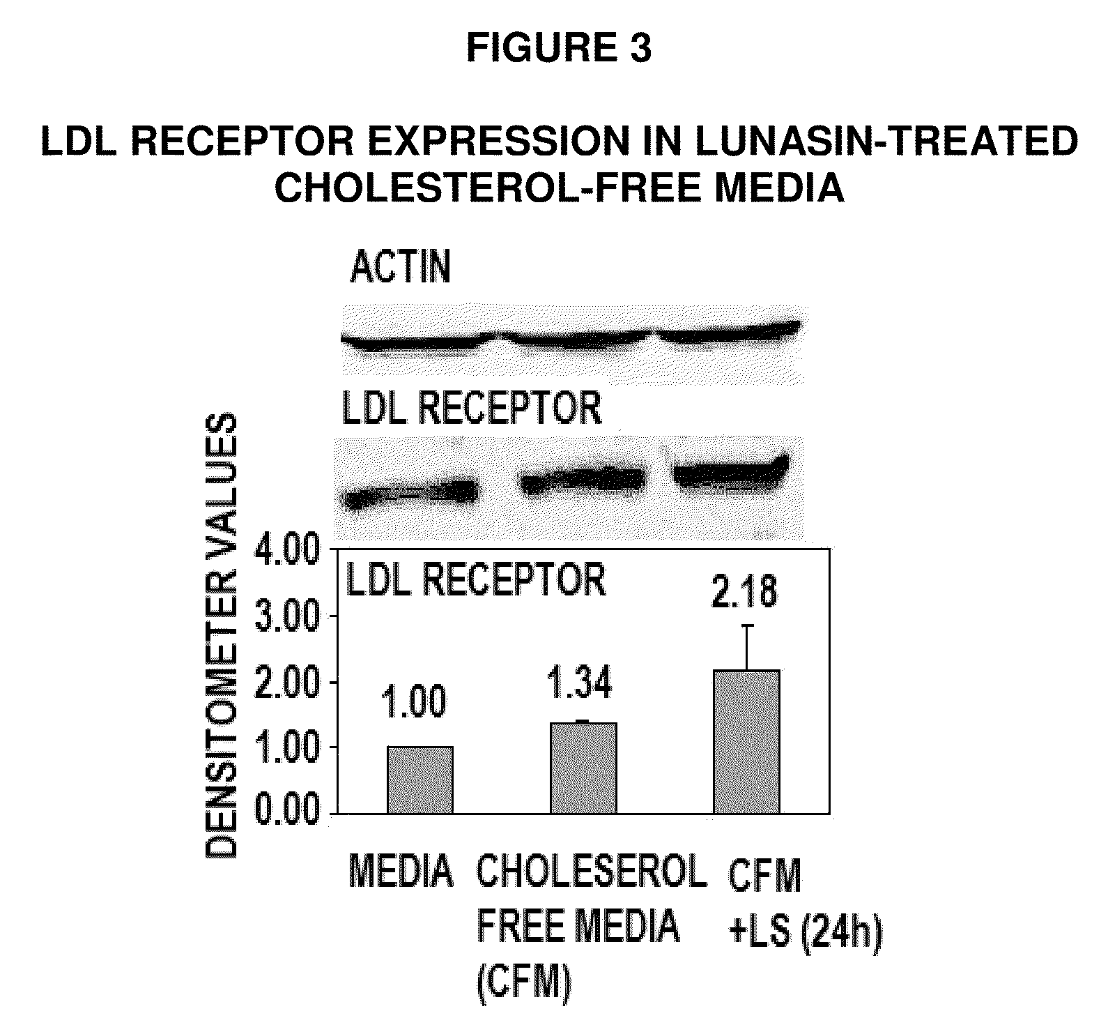 Methods for using soy peptides to inhibit h3 acetylation, reduce expression of hmg-coa reductase and increase ldl receptor and sp1 expression in a mammal