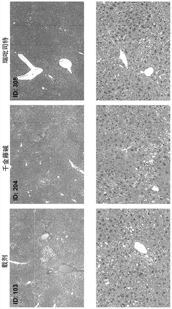 Compositions and methods for treating non-alcoholic steatohepatitis