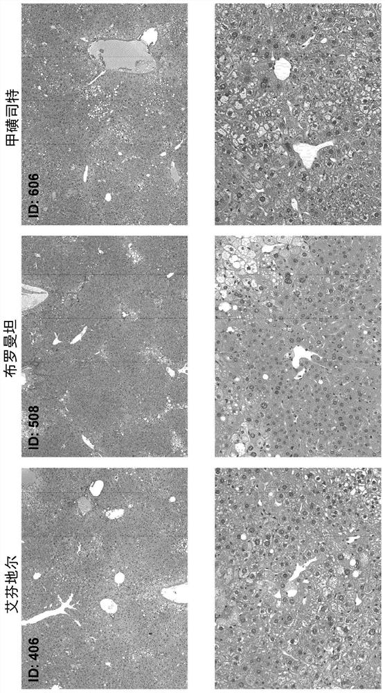 Compositions and methods for treating non-alcoholic steatohepatitis