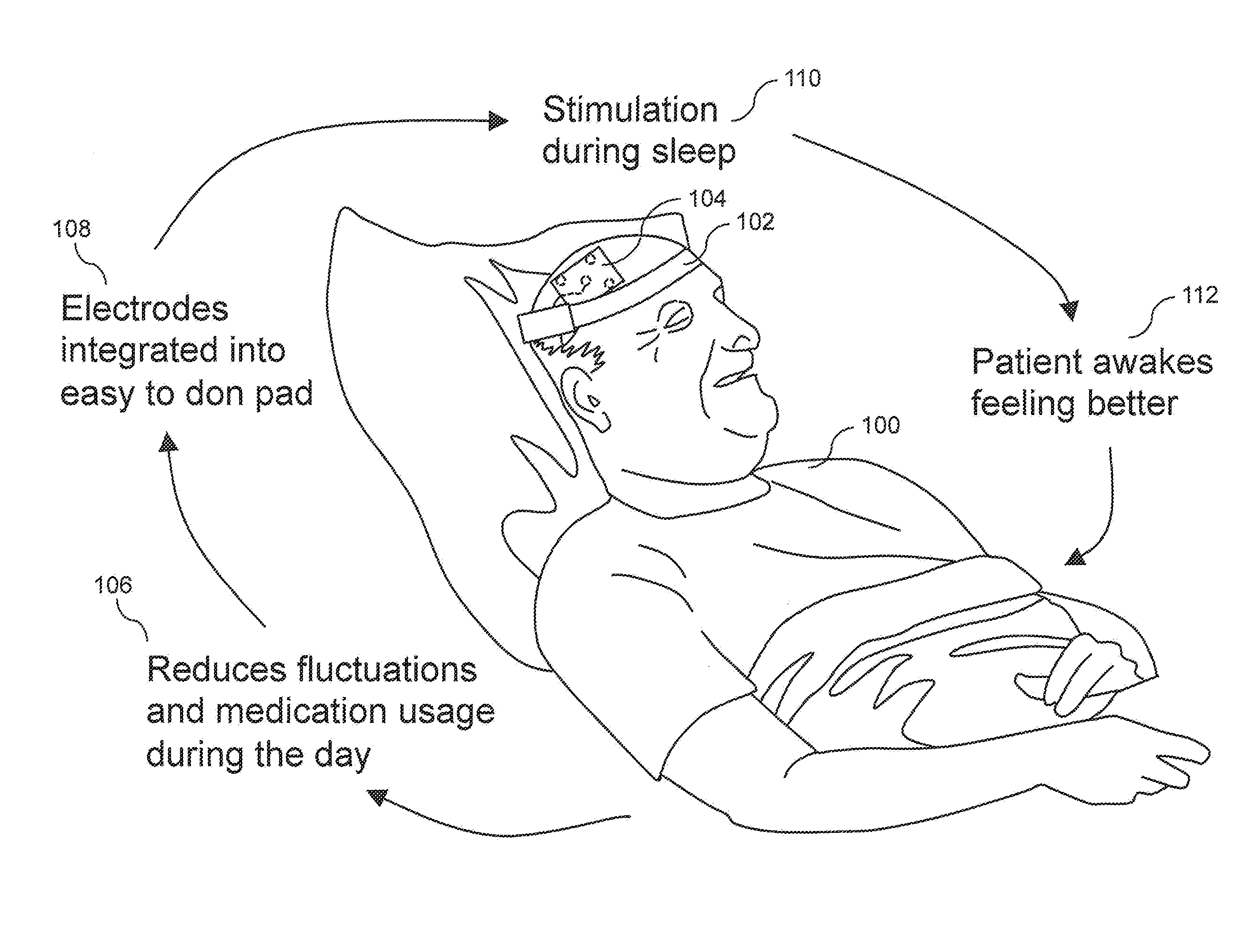 Wearable, unsupervised transcranial direct current stimulation (tDCS) device for movement disorder therapy, and method of using