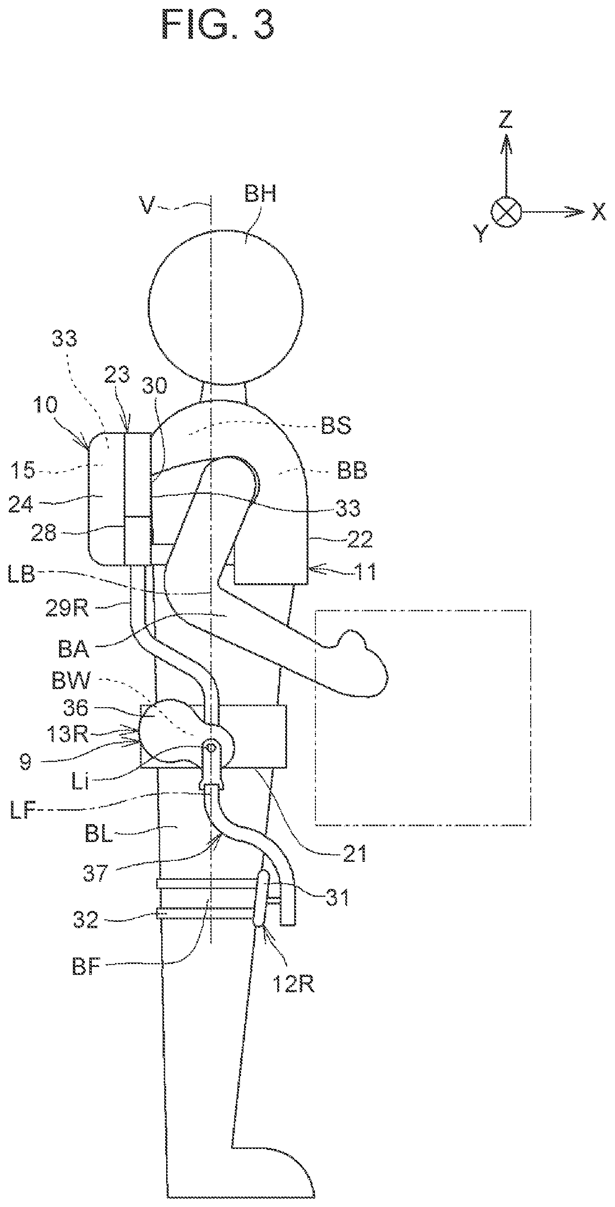 Assist device