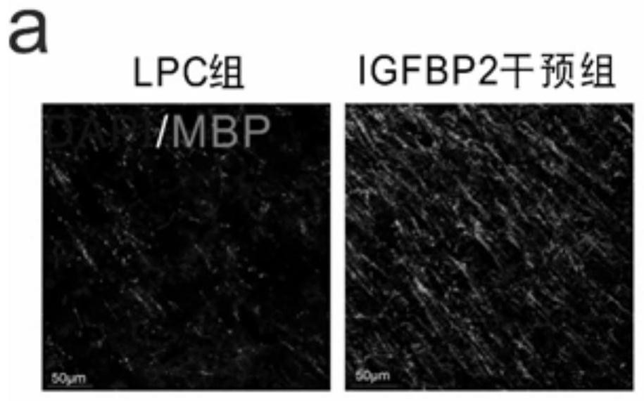 Application of insulin-like growth factor binding protein 2 in preparation of medicine for treating nerve demyelinating diseases