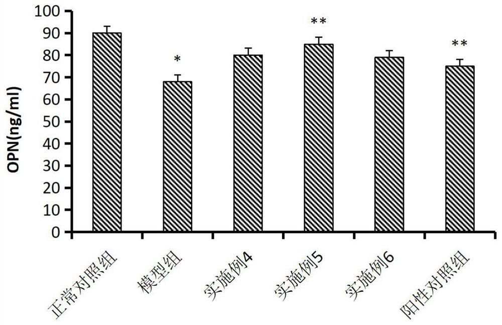 Vitamin K2-containing pharmaceutical composition for improving cardiovascular calcification as well as preparation method and application thereof