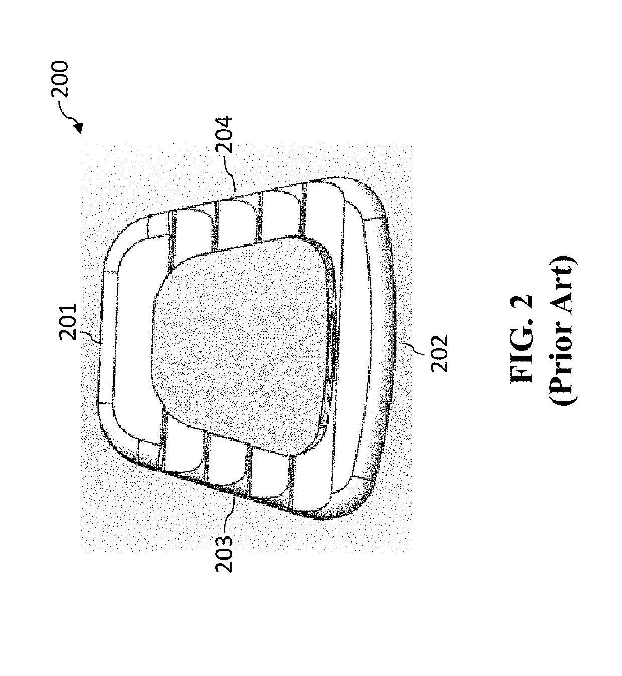 Medical implant having an anchoring system and method of use thereof