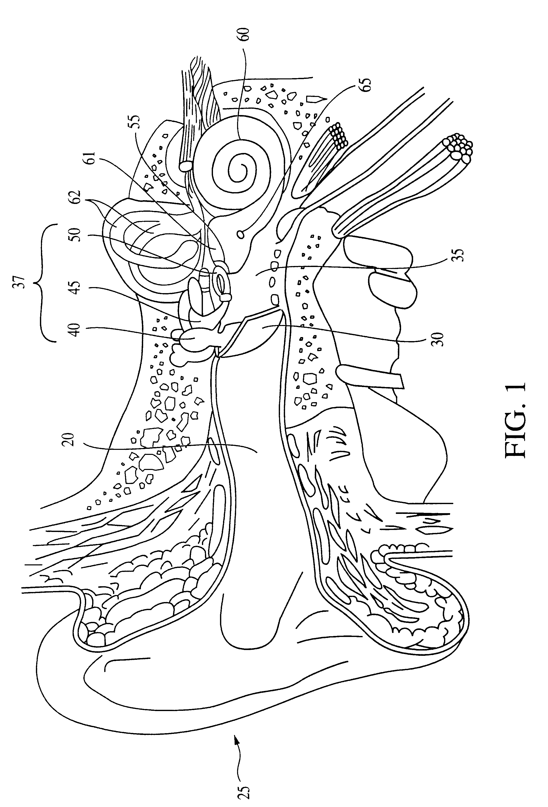 Method and apparatus for a programmable implantable hearing aid