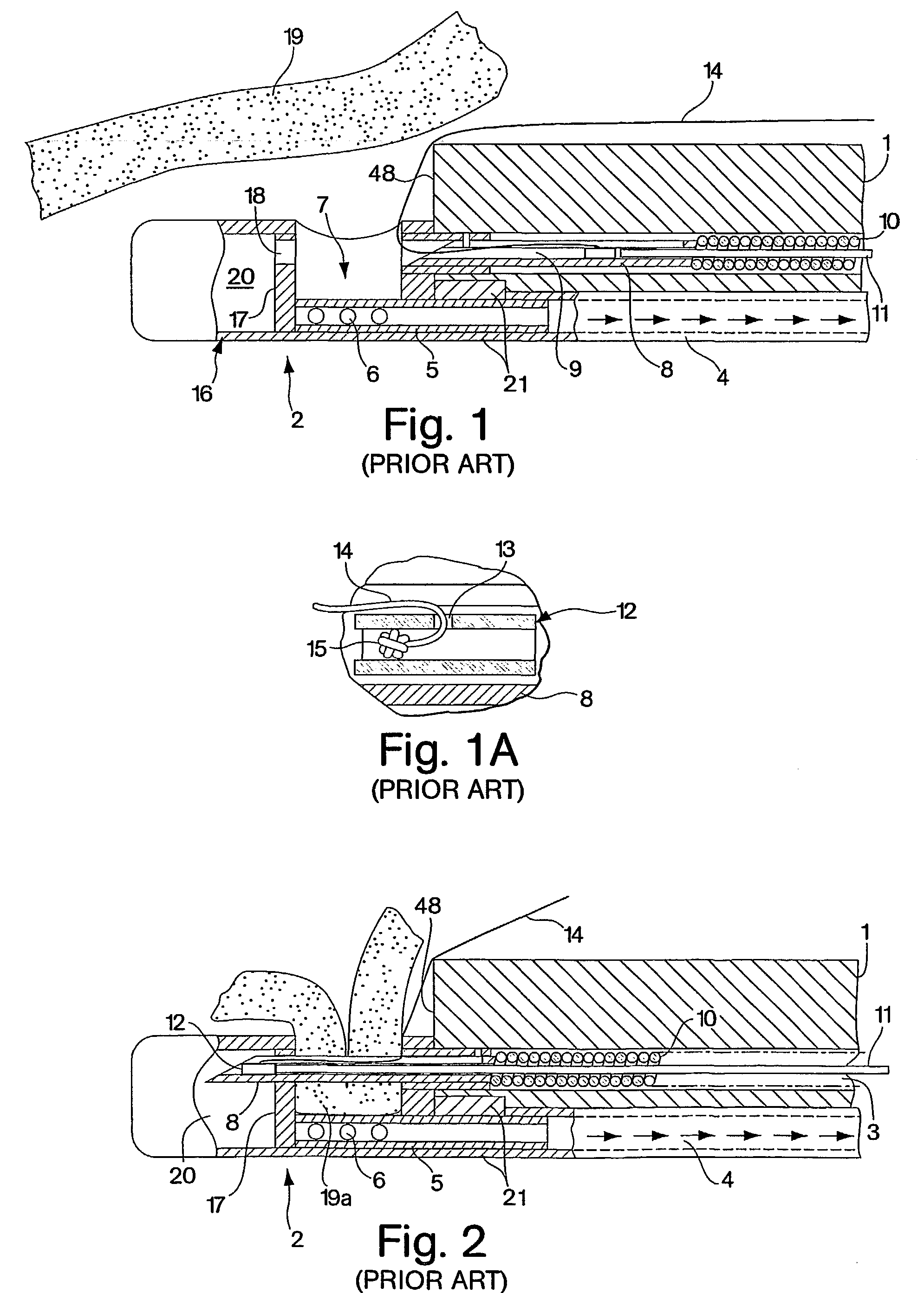 Endoscopic tissue apposition device with multiple suction ports