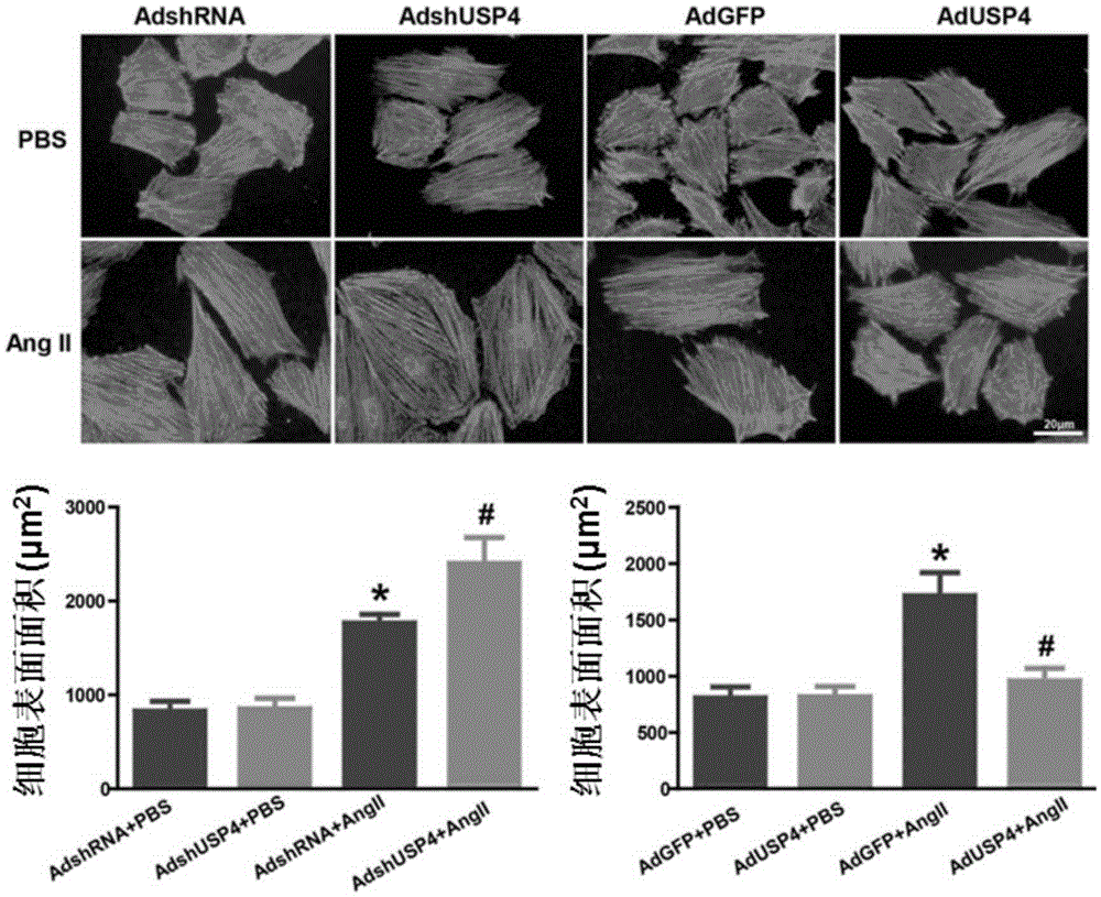 Function and application of ubiquitin specific protease 4 (USP4) in treating cardiac hypertrophy