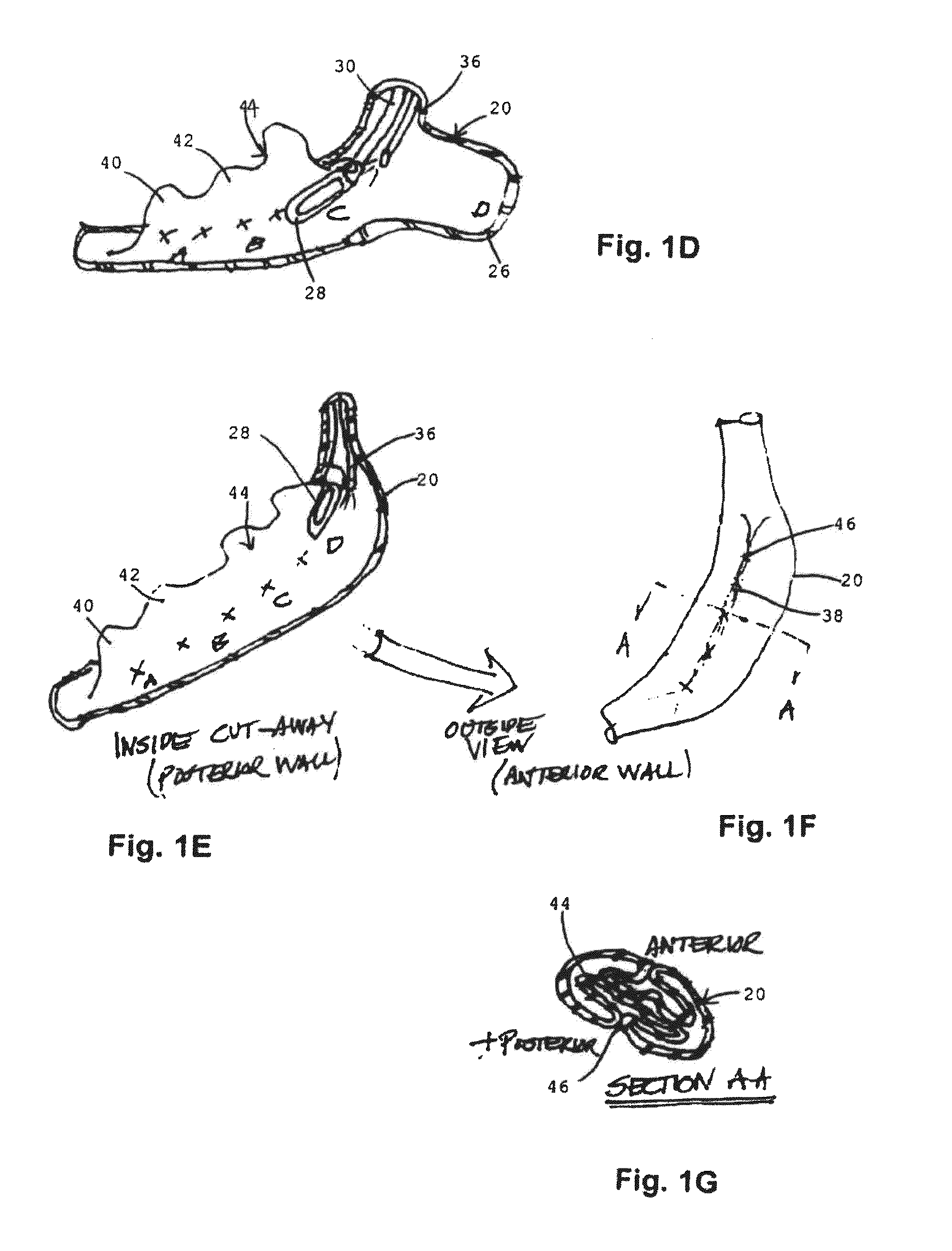 Tissue-acquisition and fastening devices and methods
