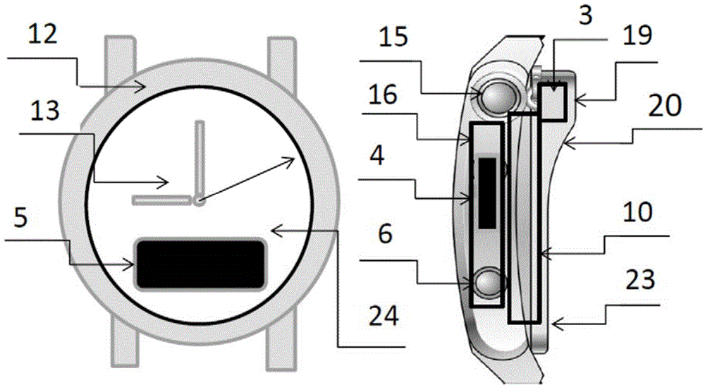 Wearable APP synchronous pointer type timing light quantum treatment watch