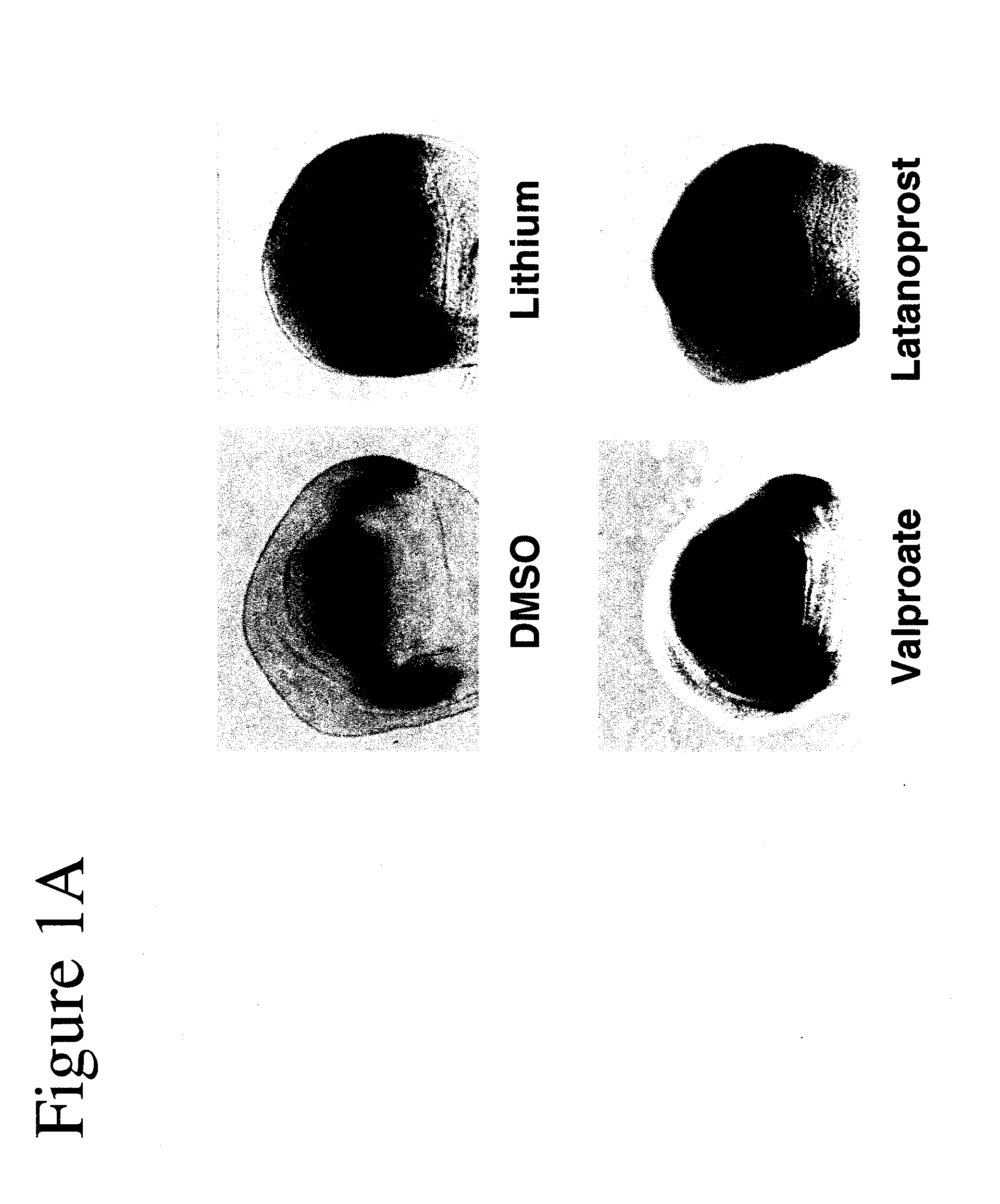 Compositions comprising a prostaglandin for treating neuropsychiatric conditions