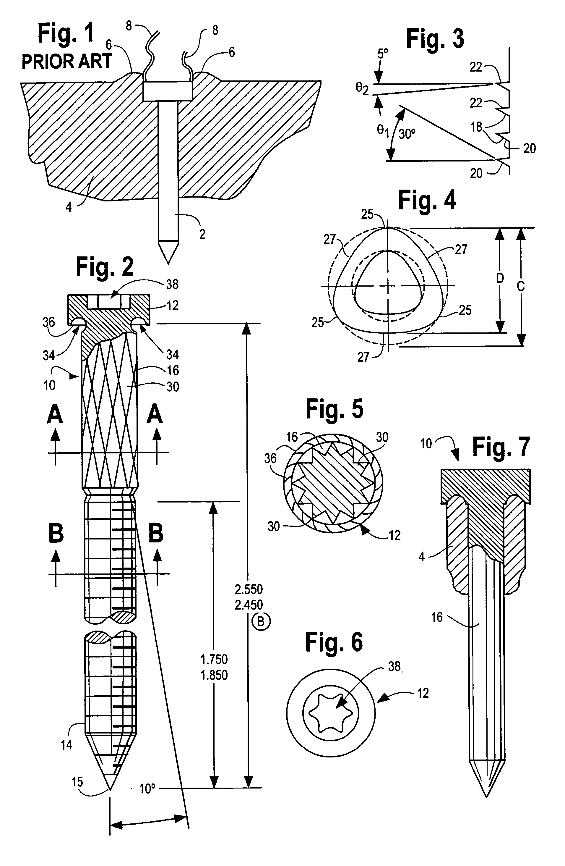Hybrid screw for composite lumber and wood