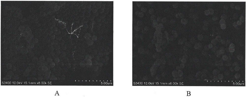 A kind of preparation method of ferrous chelating antimicrobial peptide