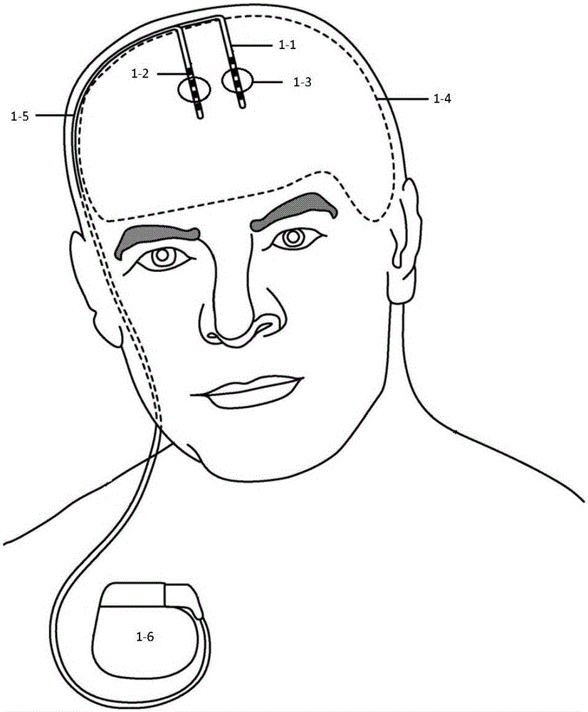 System and method for detecting and positioning brain stimulation target point