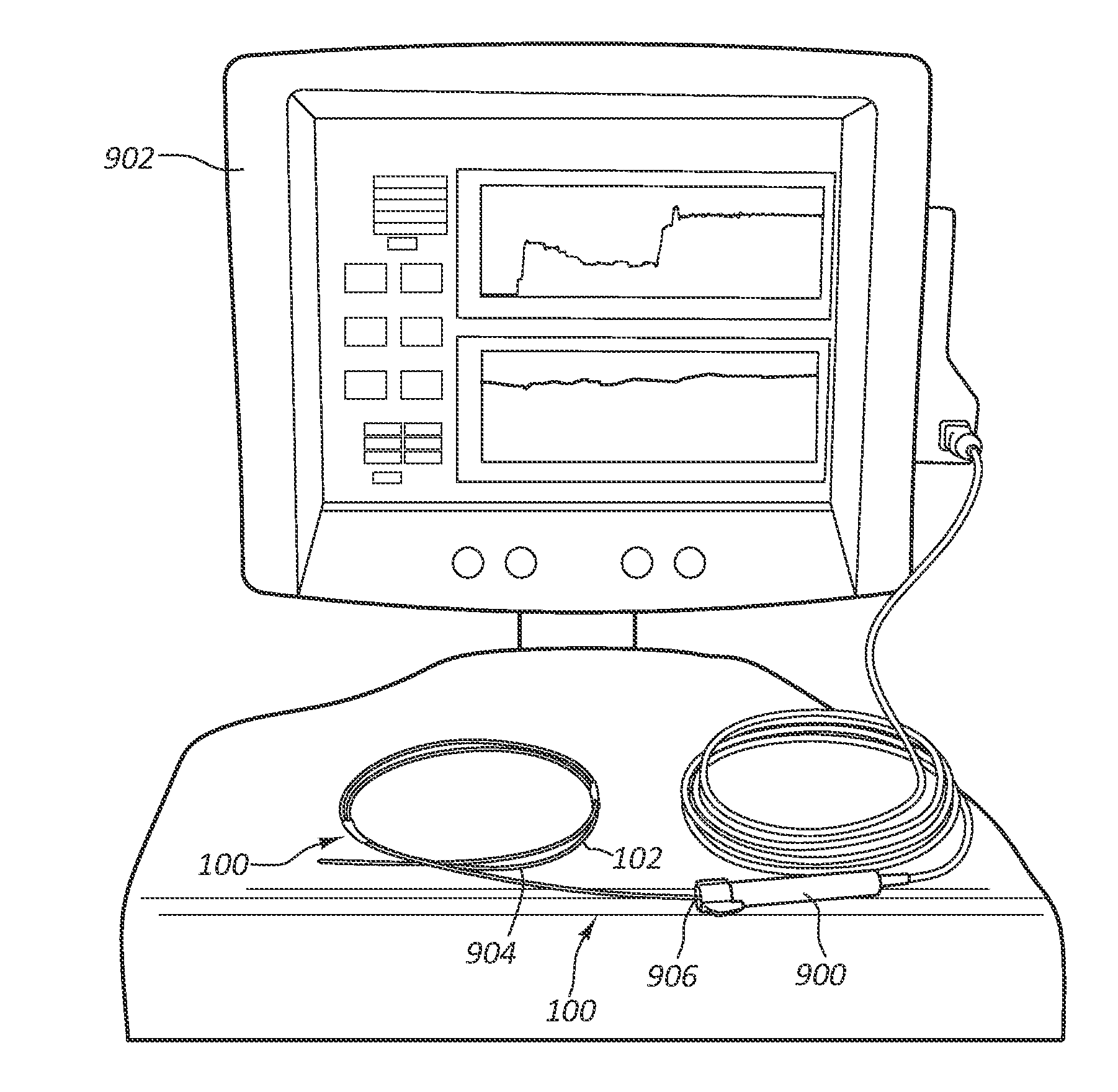 Apparatus and Methods Relating to Intravascular Positioning of Distal End of Catheter