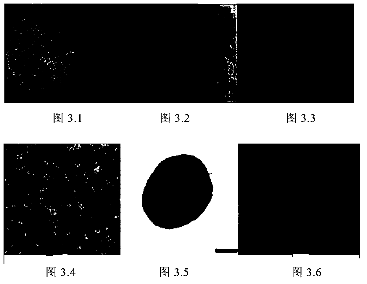 Application of allogenic stromal vascular fraction cells and allogenic mesenchymal progenitor cells in prevention or treatment of rheumatoid arthritis