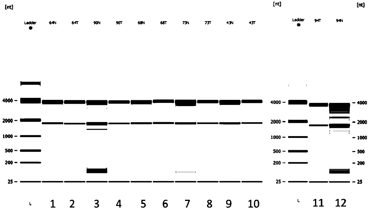 Pair of primers for amplifying LINC02253 gene and application thereof