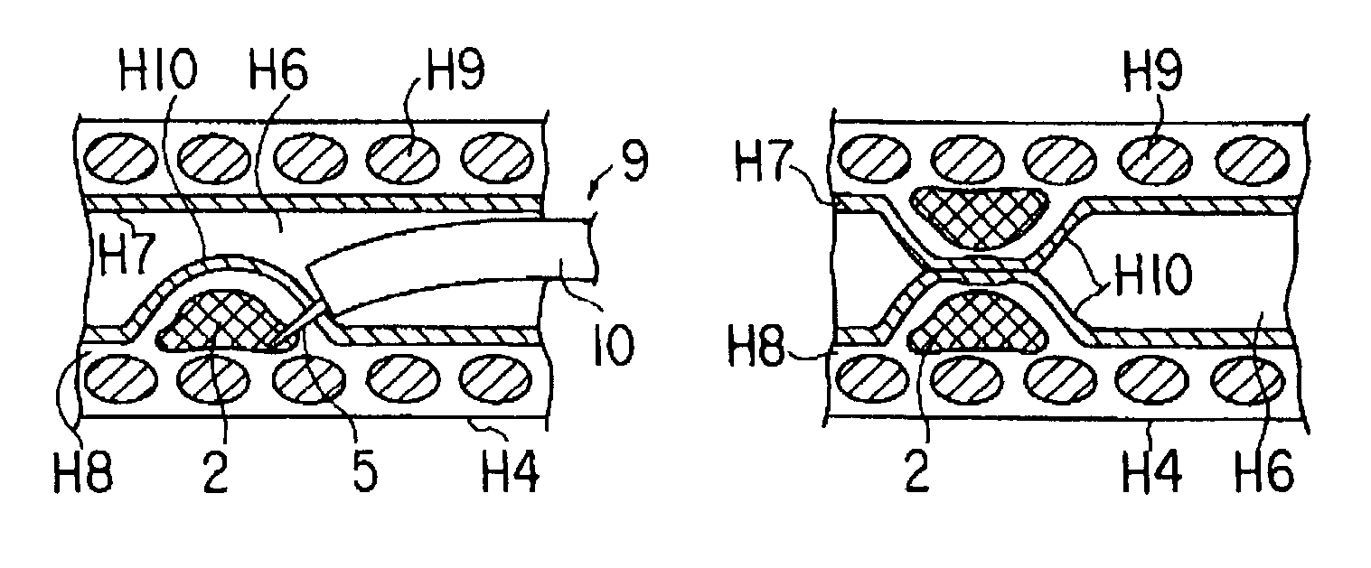 Medical device and method of embolizing bronchus or bronchiole