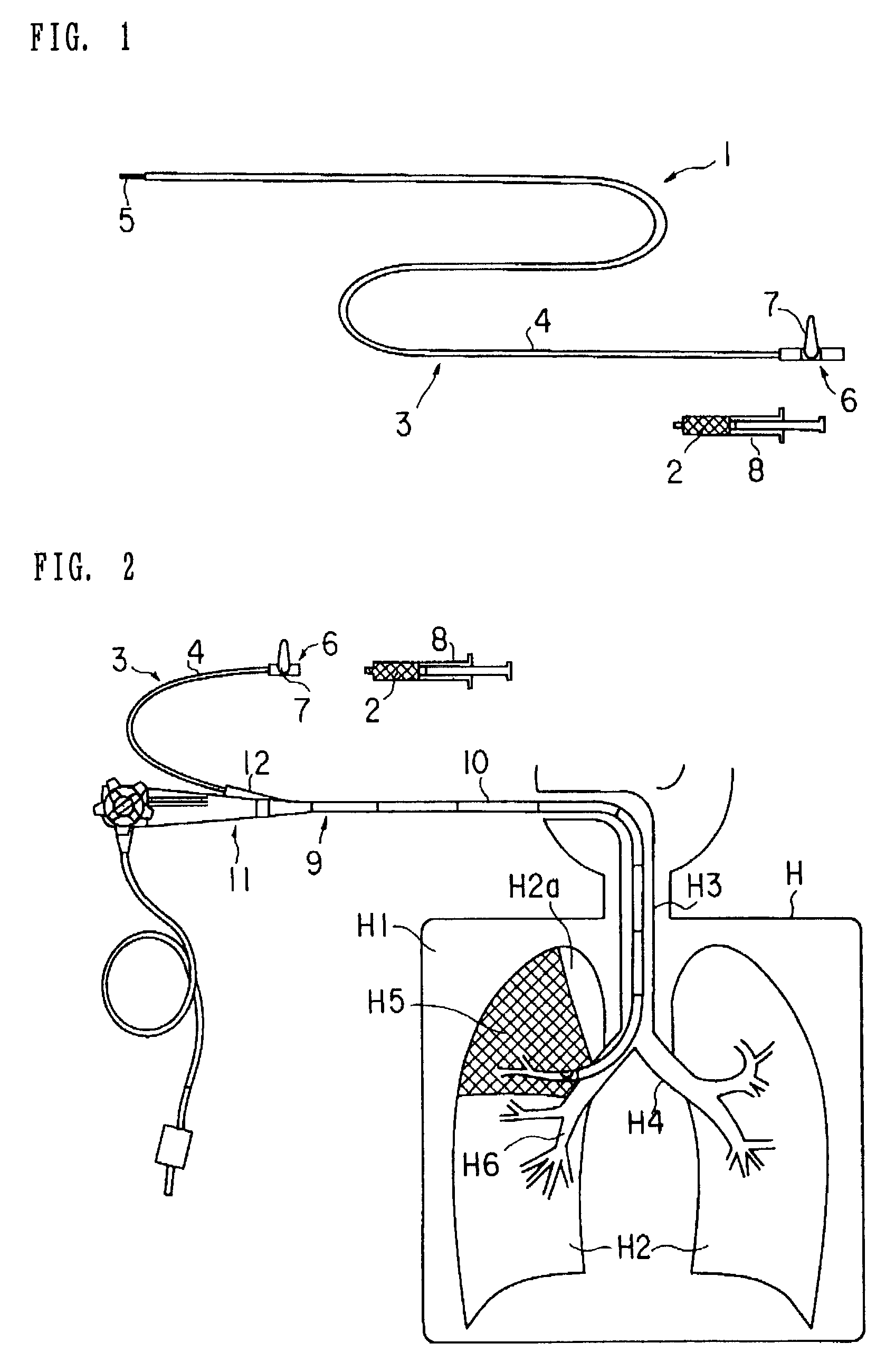 Medical device and method of embolizing bronchus or bronchiole