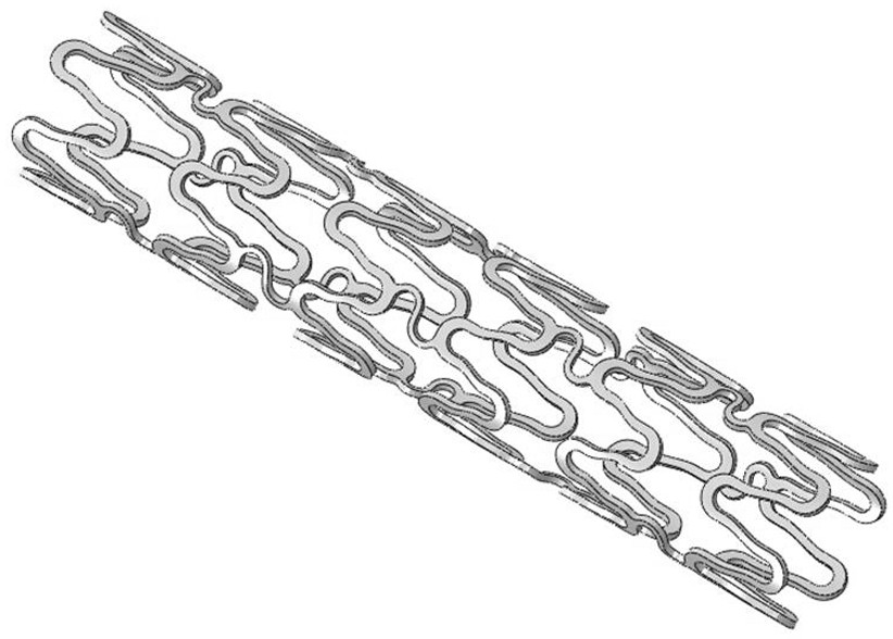 Magnesium alloy degradable stent applied to curved pathological cerebral vascular