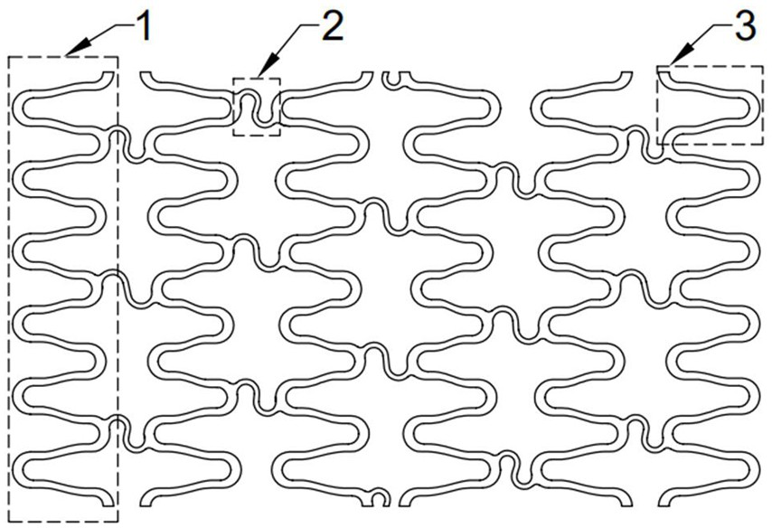 Magnesium alloy degradable stent applied to curved pathological cerebral vascular