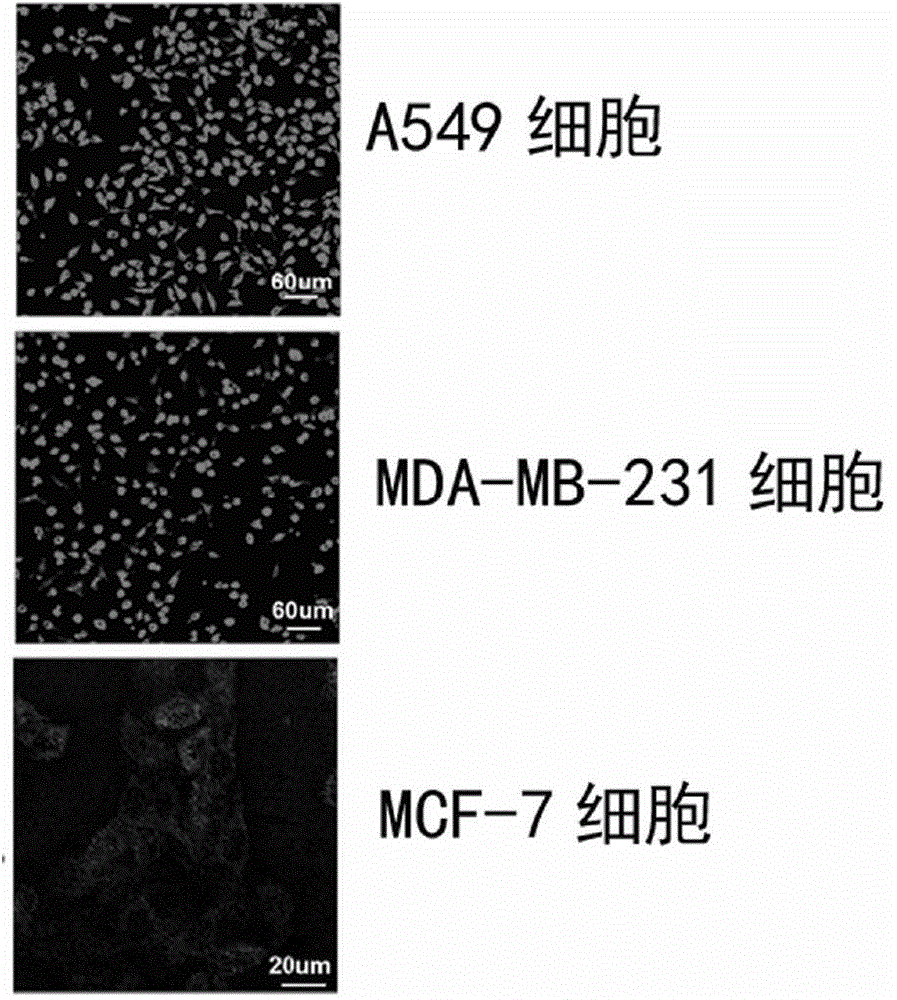 Anti-tumor bispecific miniaturized antibody with double functions of targeting therapy and detection