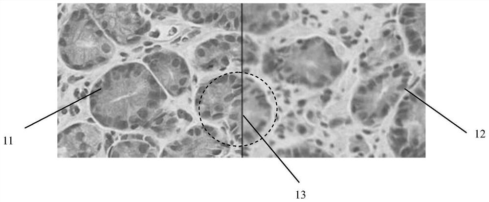 A system and method for detecting the definition of digital pathological slides