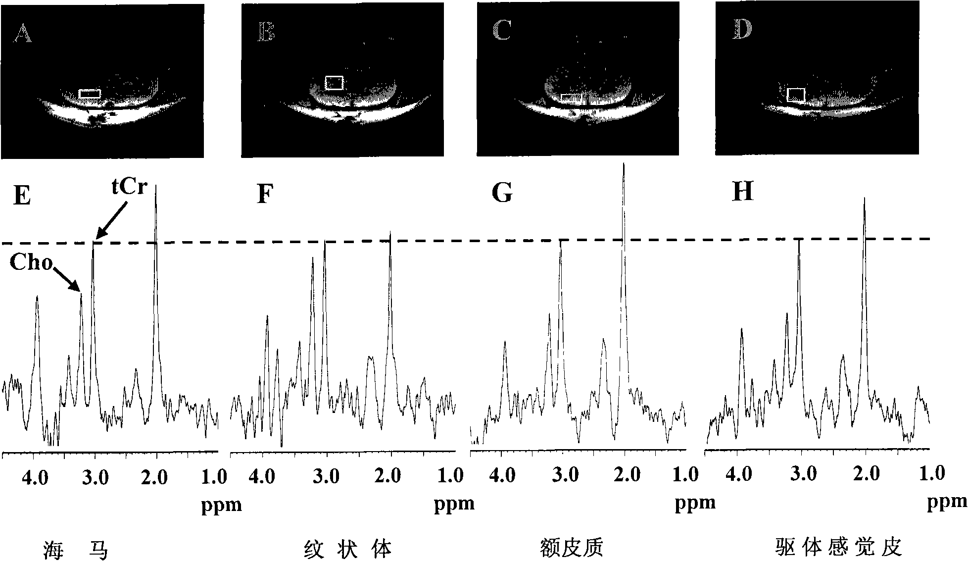 Method for acetyl choline content indirect detection by proton magnetic resonance wave spectrum analysis