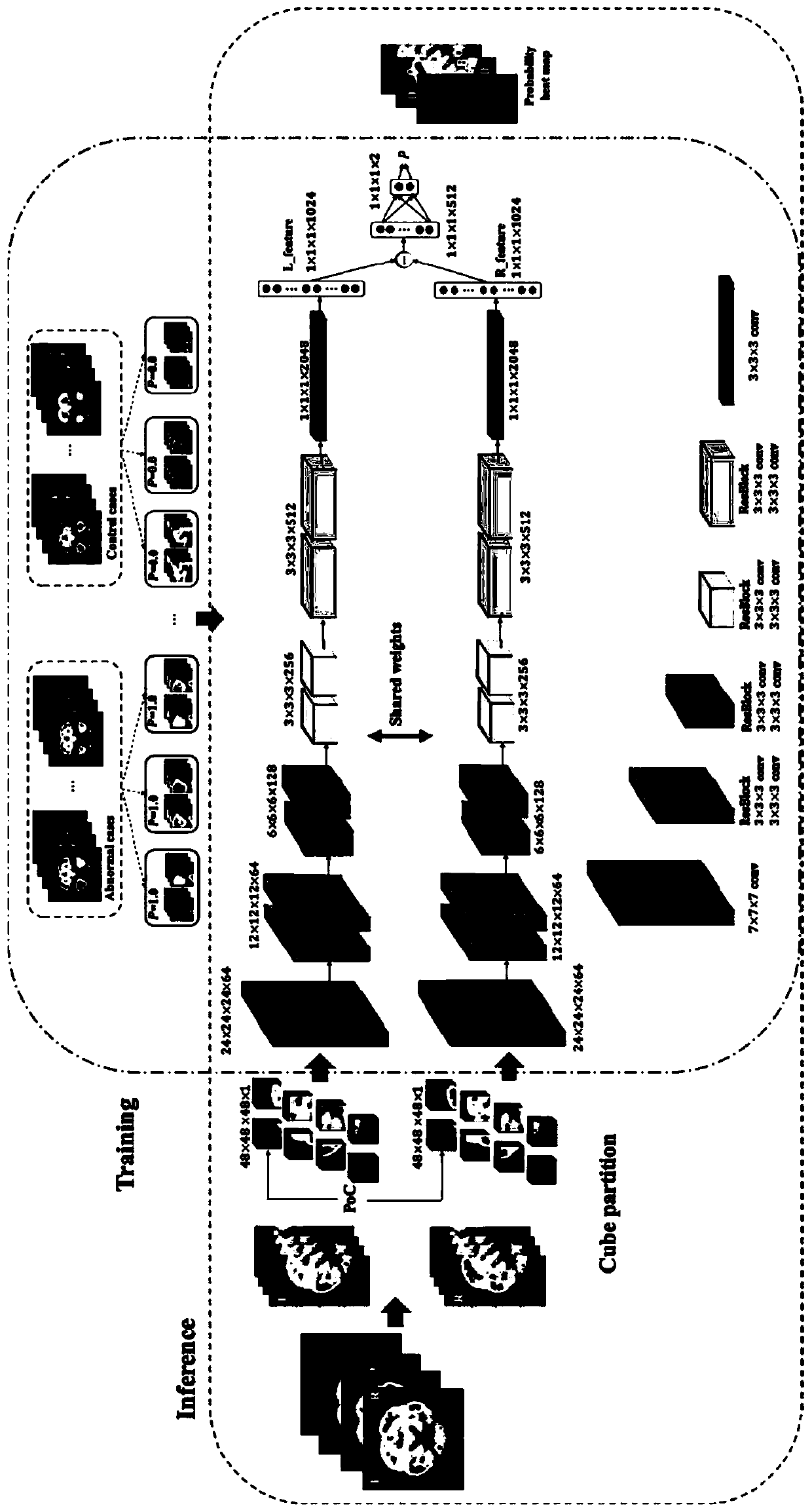 A three-dimensional automatic positioning system for epileptogenic focus based on deep learning