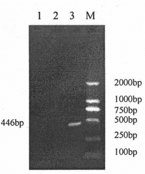 PCR method for detecting duck viral enteritis and kit thereof